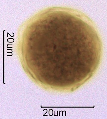 Barberry (Berberis thunbergii) Pollen