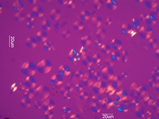 Barley Starch Under the Microscope