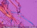 Chrysotile Asbestos