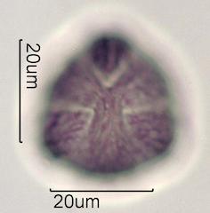 Pollen from Bigleaf Maple (Acer macrophyllum) Under the Microscope
