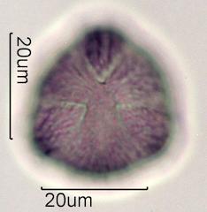 Pollen from Bigleaf Maple (Acer macrophyllum) Under the Microscope