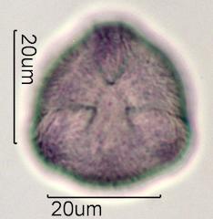 Pollen from Bigleaf Maple (Acer macrophyllum) Under the Microscope