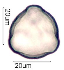 Pollen from Bigleaf Maple (Acer macrophyllum) Under the Microscope