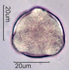 Pollen from Bigleaf Maple (Acer macrophyllum) Under the Microscope