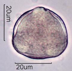 Pollen from Bigleaf Maple (Acer macrophyllum) Under the Microscope