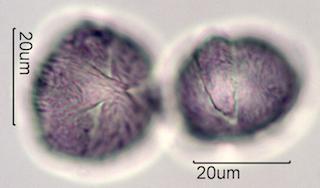 Pollen from Bigleaf Maple (Acer macrophyllum) Under the Microscope