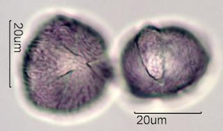 Pollen from Bigleaf Maple (Acer macrophyllum) Under the Microscope