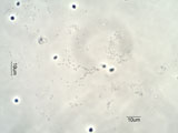 Biofilm from Drinking Water Under the Microscope