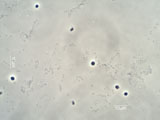 Biofilm from Drinking Water Under the Microscope