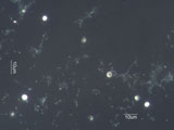 Biofilm from Drinking Water Under the Microscope