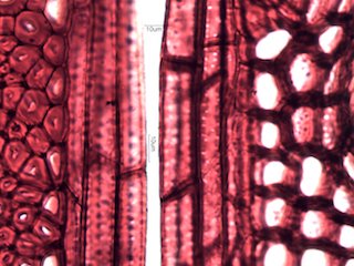 Black Locust, Cross-Section