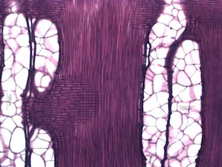 Black Locust, Radial Section