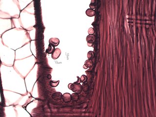 Black Locust, Radial Section