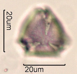 Blackberry Pollen Under the Microscope
