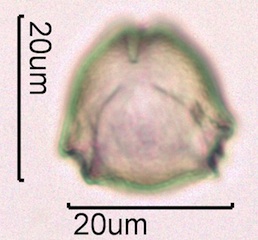 Blackberry Pollen Under the Microscope