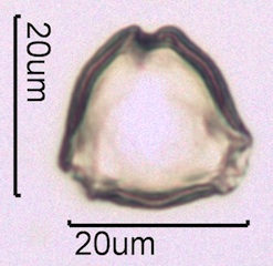 Blackberry Pollen Under the Microscope