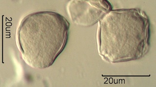 Blackberry Pollen Under the Microscope