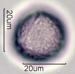 Pollen from Bleeding Heart (Lamprocapnos spectabilis) Under the Microscope