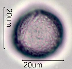 Pollen from Bleeding Heart (Lamprocapnos spectabilis) Under the Microscope