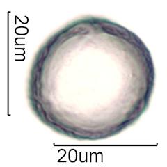 Pollen from Bleeding Heart (Lamprocapnos spectabilis) Under the Microscope