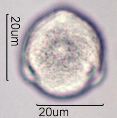 Pollen from Bleeding Heart (Lamprocapnos spectabilis) Under the Microscope