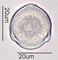 Pollen from Bleeding Heart (Lamprocapnos spectabilis) Under the Microscope