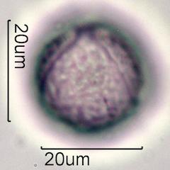 Pollen from Bleeding Heart (Lamprocapnos spectabilis) Under the Microscope
