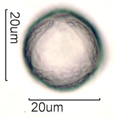 Pollen from Bleeding Heart (Lamprocapnos spectabilis) Under the Microscope