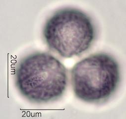 Pollen from Bleeding Heart (Lamprocapnos spectabilis) Under the Microscope