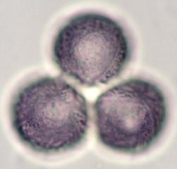Pollen from Bleeding Heart (Lamprocapnos spectabilis) Under the Microscope