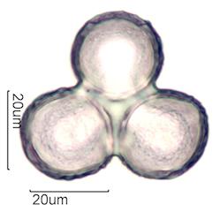 Pollen from Bleeding Heart (Lamprocapnos spectabilis) Under the Microscope