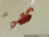 Blood Sucking Insect Frass