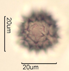 Australian Honey Pollen Under the Microscope