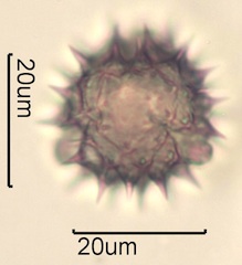 Australian Honey Pollen Under the Microscope