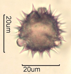Australian Honey Pollen Under the Microscope