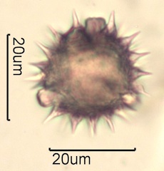 Australian Honey Pollen Under the Microscope