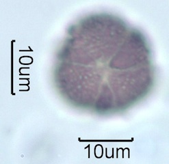 Australian Honey Pollen Under the Microscope
