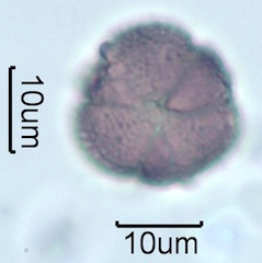 Australian Honey Pollen Under the Microscope