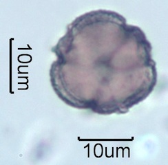 Australian Honey Pollen Under the Microscope