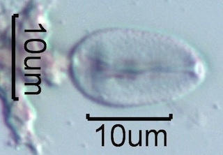 Australian Honey Pollen Under the Microscope