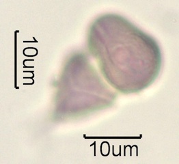 Australian Honey Pollen Under the Microscope