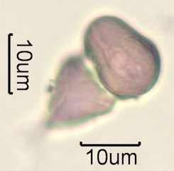 Australian Honey Pollen Under the Microscope