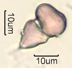 Australian Honey Pollen Under the Microscope