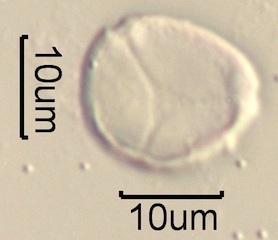 Australian Honey Pollen Under the Microscope