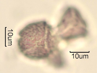 Australian Honey Pollen Under the Microscope