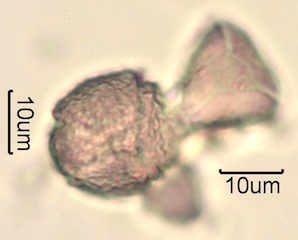 Australian Honey Pollen Under the Microscope