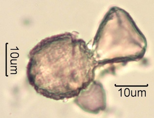 Australian Honey Pollen Under the Microscope
