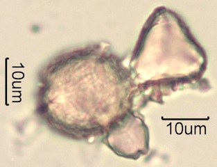 Australian Honey Pollen Under the Microscope