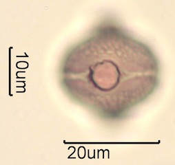 Red Clover (Trifolium pretense) Pollen Under the Microscope