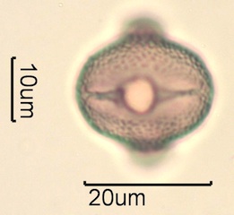 Red Clover (Trifolium pretense) Pollen Under the Microscope